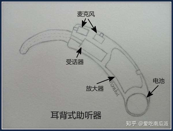 助听器是什么它的工作原理是怎样的