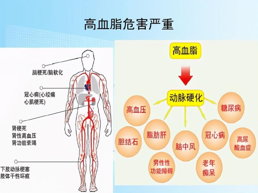 高血脂患者和心血管专家门诊对话从中可以学习到如何控制血脂