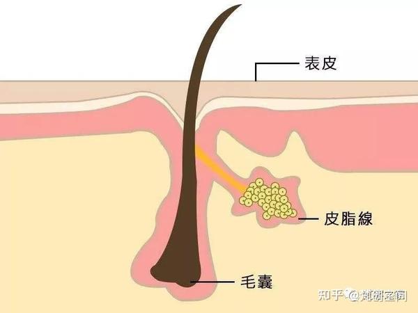 【皮肤管理】每天做这4件事,黑头再也不长了!▏远离草莓鼻