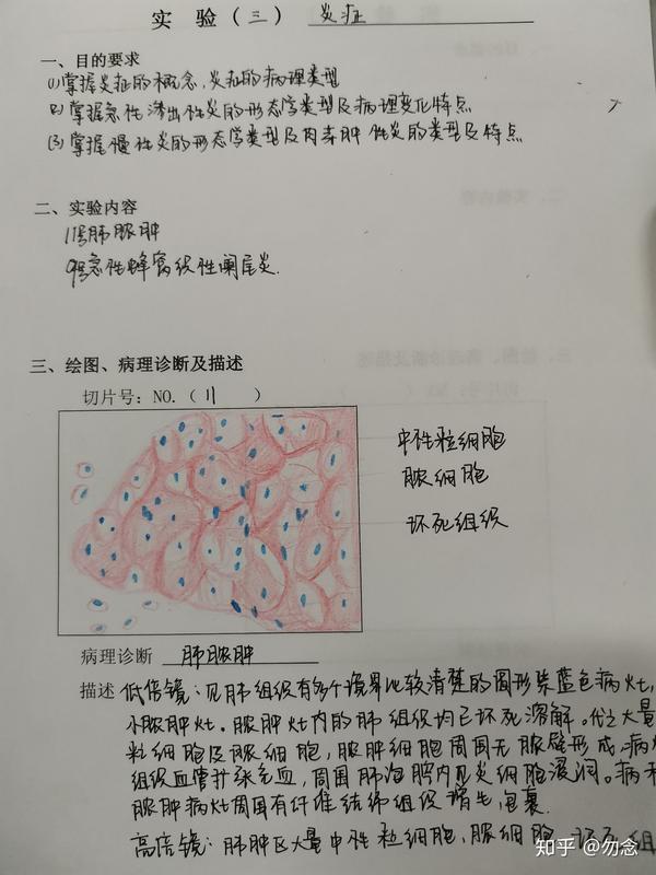 病理实验 肝脂肪变性,混合血栓,肺脓肿,急性蜂窝组织阑尾炎 绘图,病理