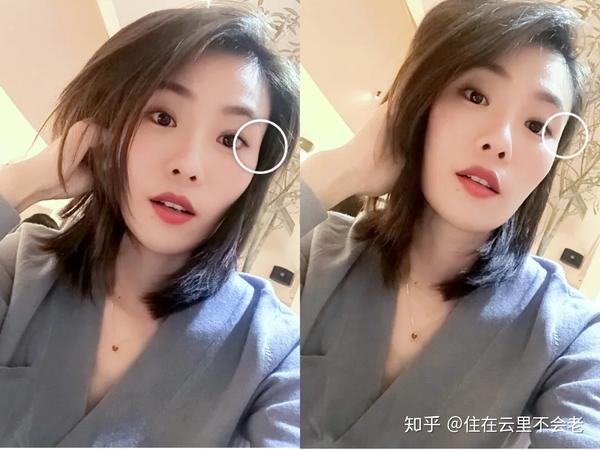 高颧骨女孩也可以微调出高级脸!