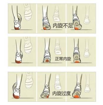 很简单,高足弓应选择缓冲避震型的,因为高足弓的脚型比较僵硬缺乏