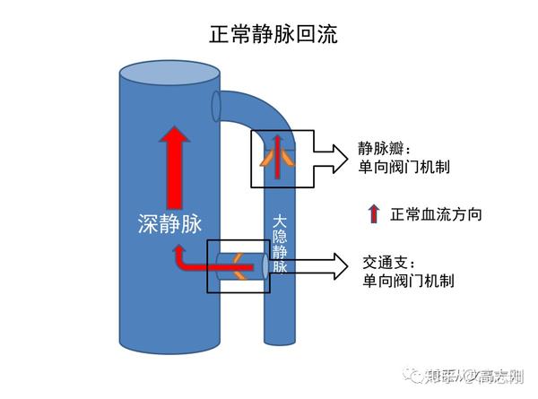 2,如果静脉瓣损伤了,大隐静脉血液异常.