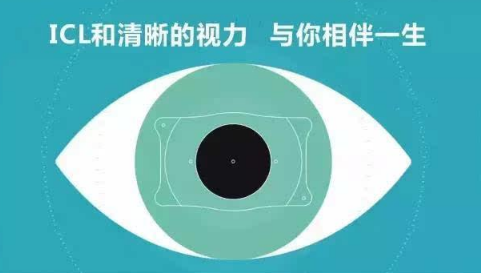 近视矫正手术能"后悔"?能!icl晶体植入可以!