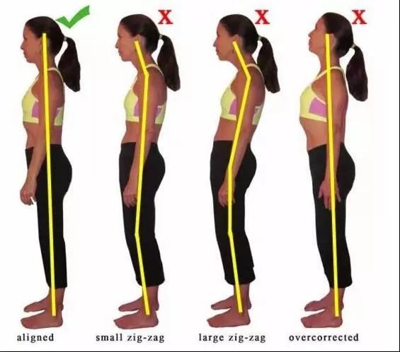 圆肩驼背头部前倾若不及时矫正严重者可导致体态变形
