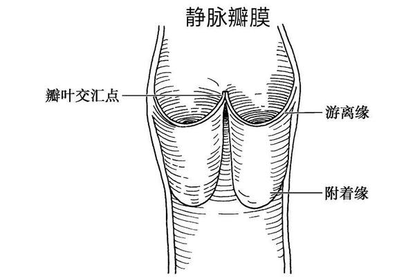 但当静脉瓣叶出现"故障,这门就关不紧了,反流的血液对静脉管产生巨大