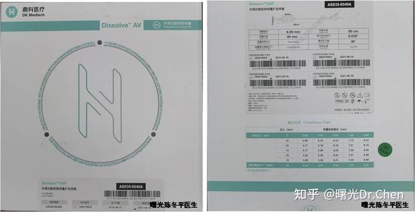 自体动静脉内瘘成熟不良后闭塞的药物刻痕球囊再开通