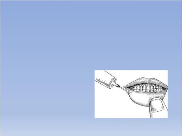 局部阻滞麻醉在上唇与下唇 口腔粘膜面的麻醉 口腔粘膜面麻醉眶下
