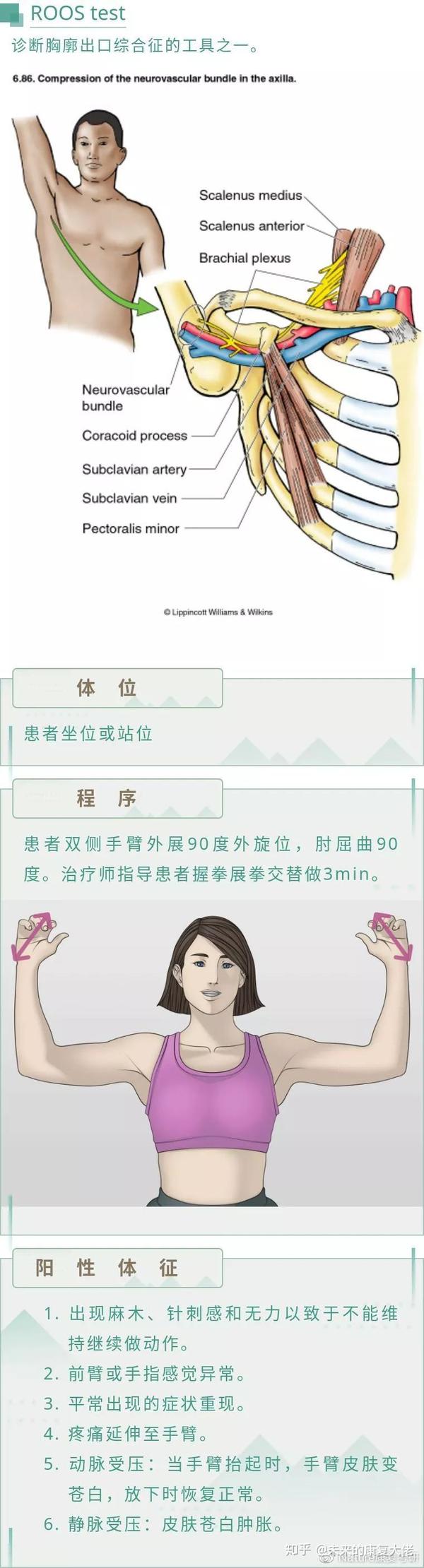 5.adson′s test