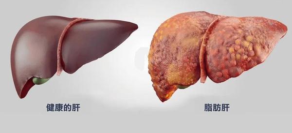 台湾长庚医院科普内脏脂肪让心肝肾都不好补充蛋白质让肝脏帮助燃烧