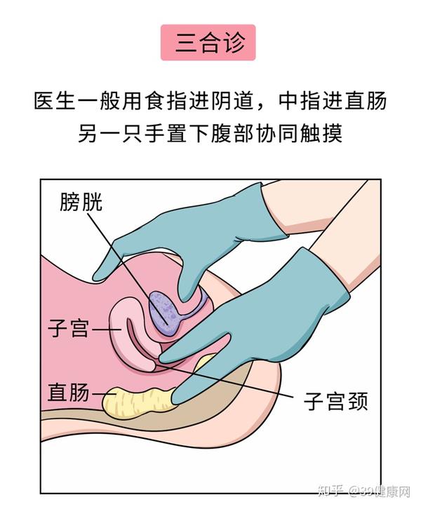 太过隐秘 如果只靠肉眼检查 所以此时 医生一般会直接上手—— "摸"