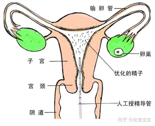 人工授精的原理是什么?