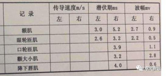 再来看一张肌电图,这个就有四对主要肌肉的波幅以及潜伏期对比.