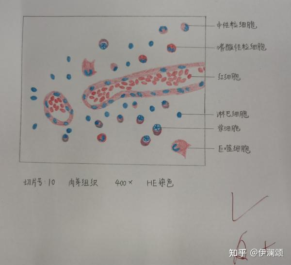 中性粒细胞:圆形,分叶核,分三到五叶,胞浆淡粉染,体积与红细胞差不多