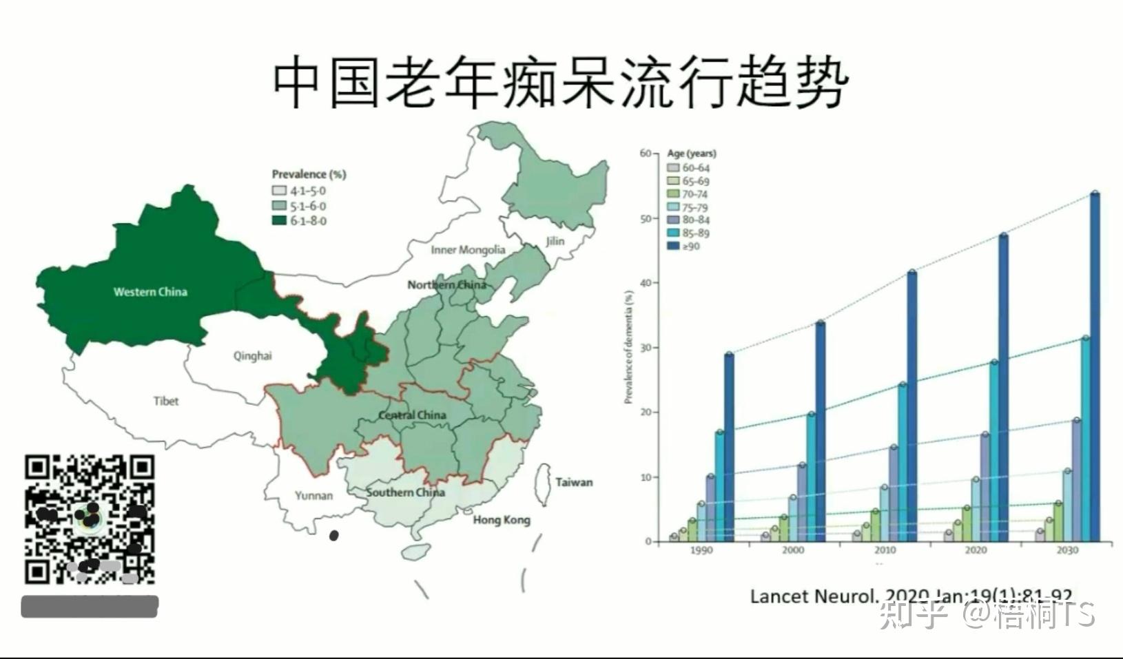 阿尔茨海默症就是老年痴呆吗哪个地区的发病率最高饮食原则是什么