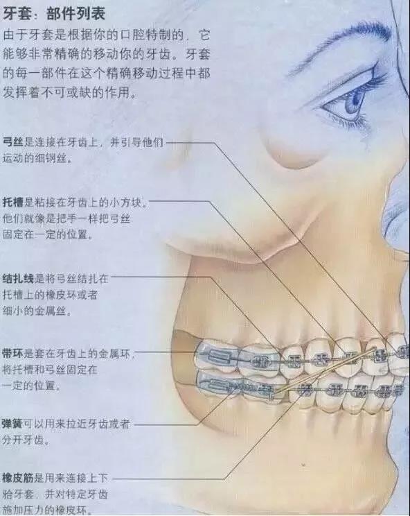 图解牙齿矫正原理,一根弓丝的力量究竟有多强大!