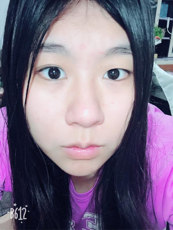 怎么从单眼皮自然变成双眼皮?