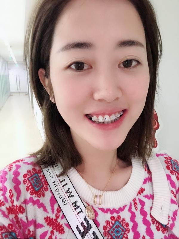 变成大龄牙套妹的日子