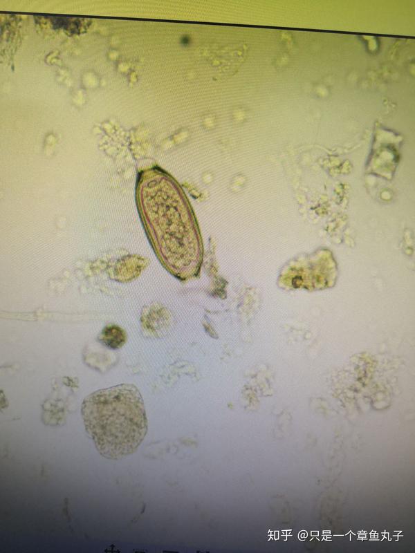 寄生虫部分显微镜下图