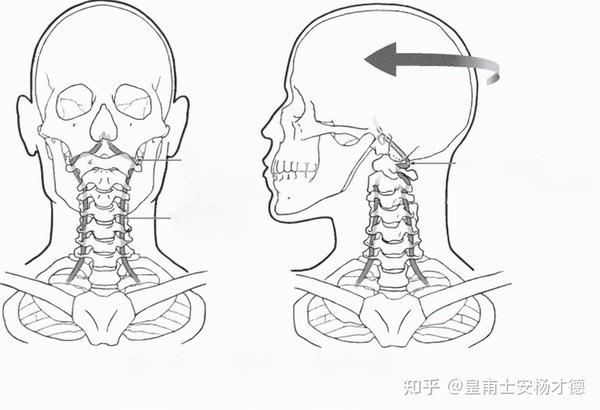 6,屈颈试验:(脊髓型) 屈颈试验:用于检查脊髓型颈椎病,患者平卧,上肢