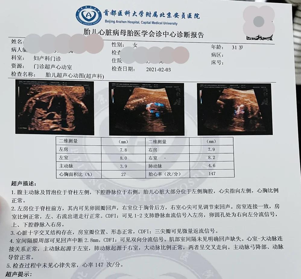 北京安贞医院胎儿超声心动攻略挂号流程