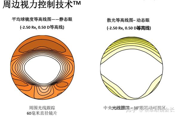 什么是普通单光镜片,什么是多焦点或功能型镜片!