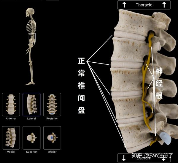 人在青年以后,随着年龄的增长,身体发生变化,脊椎骨之间的液体含量会