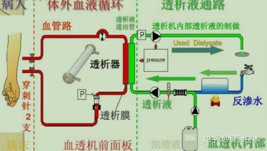 用单一的化学消毒剂很难清理血透机管路内壁的污物怎么处理?