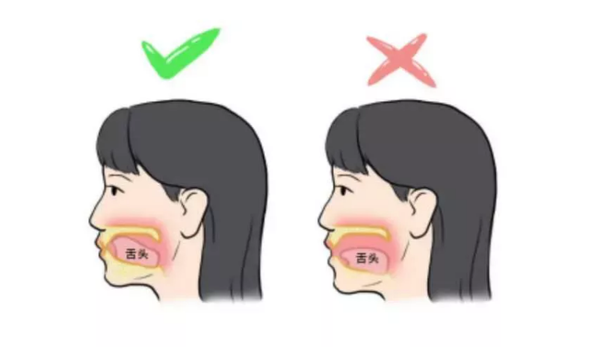 顾名思义就是用口腔呼吸,容易发生在无意识的状态下,比如睡觉,这种