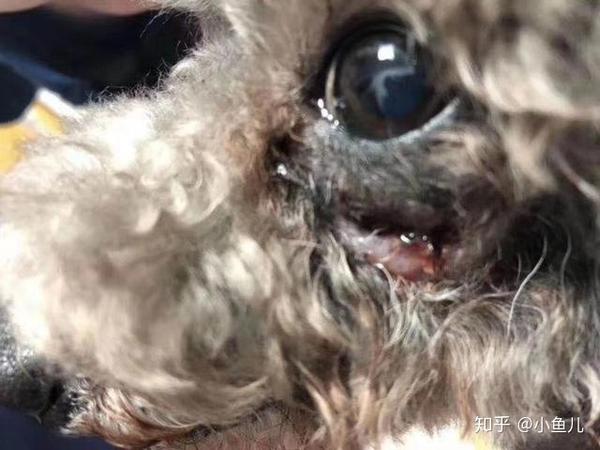 这是一例因严重牙结石,牙龈红肿萎缩,牙周炎导致的颜面瘘的案例.