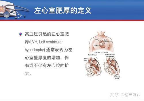 博声医疗:左心室肥大,左心室肥大的原因