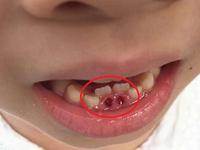 "下牙往高扔,上牙往低扔?"儿童换牙期护理,需注意这5个方面