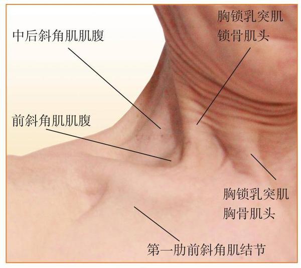 斜角肌与肋骨之间的间隙称为斜角肌间隙,是锁骨下动脉和臂丛出胸腔上