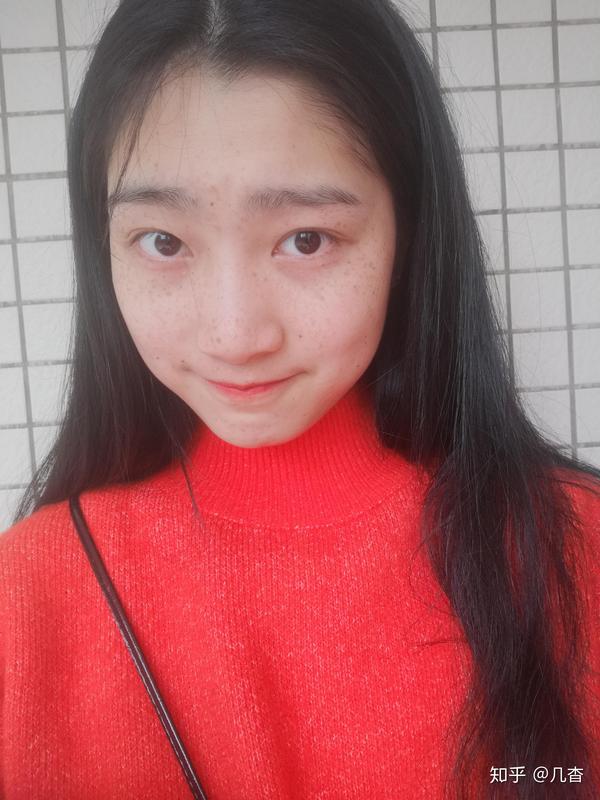 你们怎么看待雀斑女生?