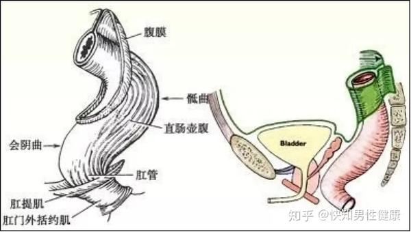 出现直肠异物卡住了怎么办?