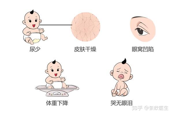 如何判断宝宝的囟门是否凹陷