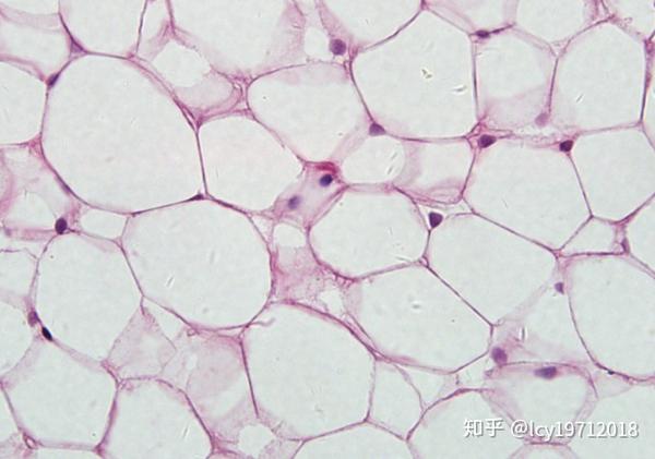 白色脂肪组织(he染色)