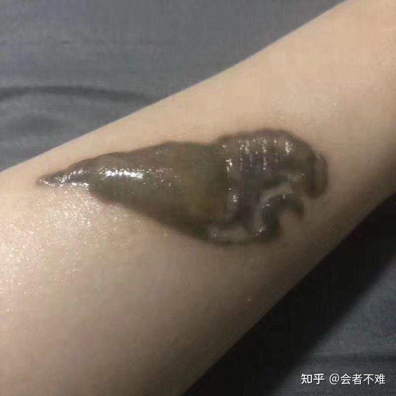 梳理一些洗纹身中常见问题