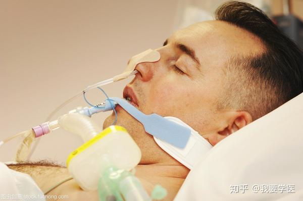 脑卒中吞咽障碍患者拔除鼻胃管时机与标准