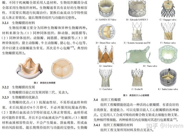 主动脉瓣膜置换手术相关文献整理选择机械瓣膜还是生物瓣膜