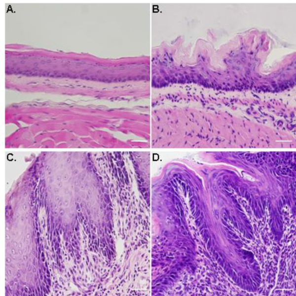 图2,小鼠食管上皮组织结构:无反流 (a),胃反流 (b),混合反流 (c)