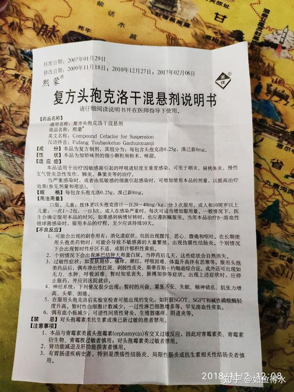 成年人得腮腺炎是一种怎么样的体验?