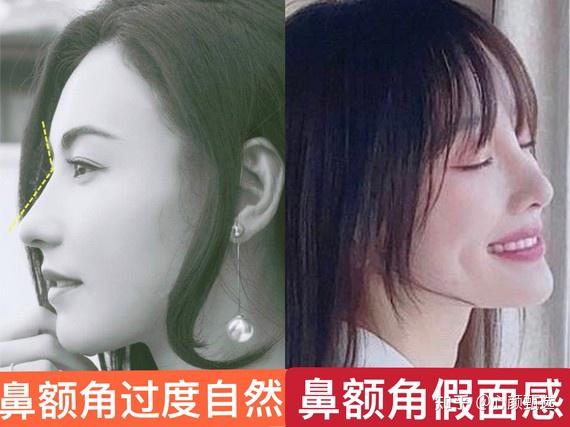 鼻子看起来很假是因为什么关于鼻部审美这三个标准你需要了解