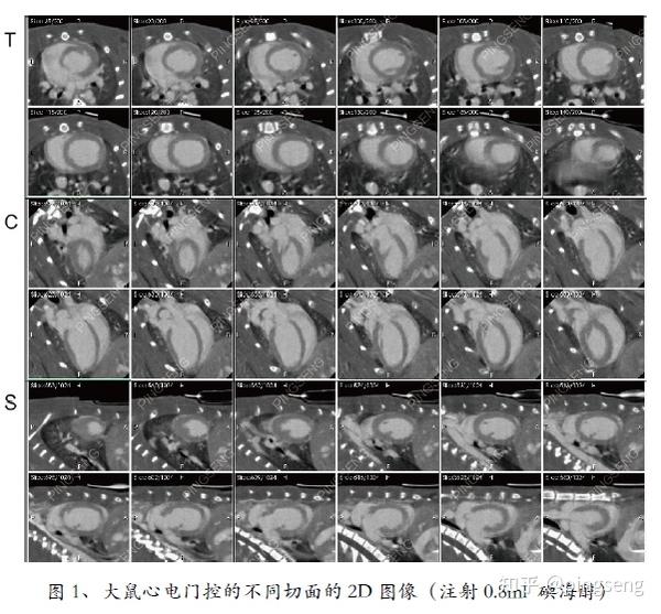 心电门控在micro ct中的应用