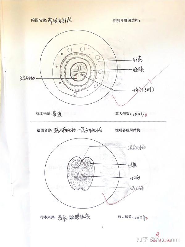 肝吸虫虫卵,肠吸虫虫卵