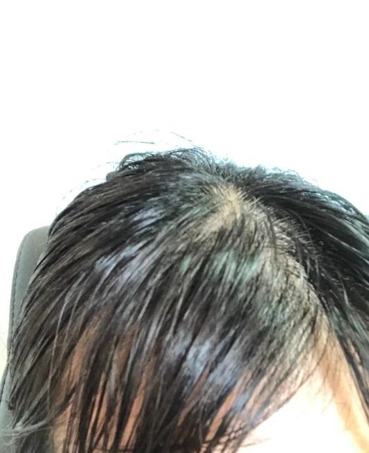 如何使自己的头发变浓密