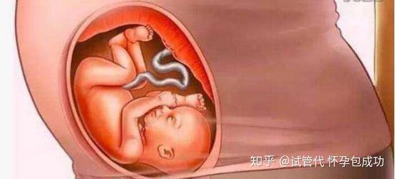 十张图带你了解怀胎十月全过程,生而为人要感恩,孝顺妈妈