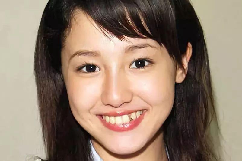 为什么日本人的牙齿这么丑
