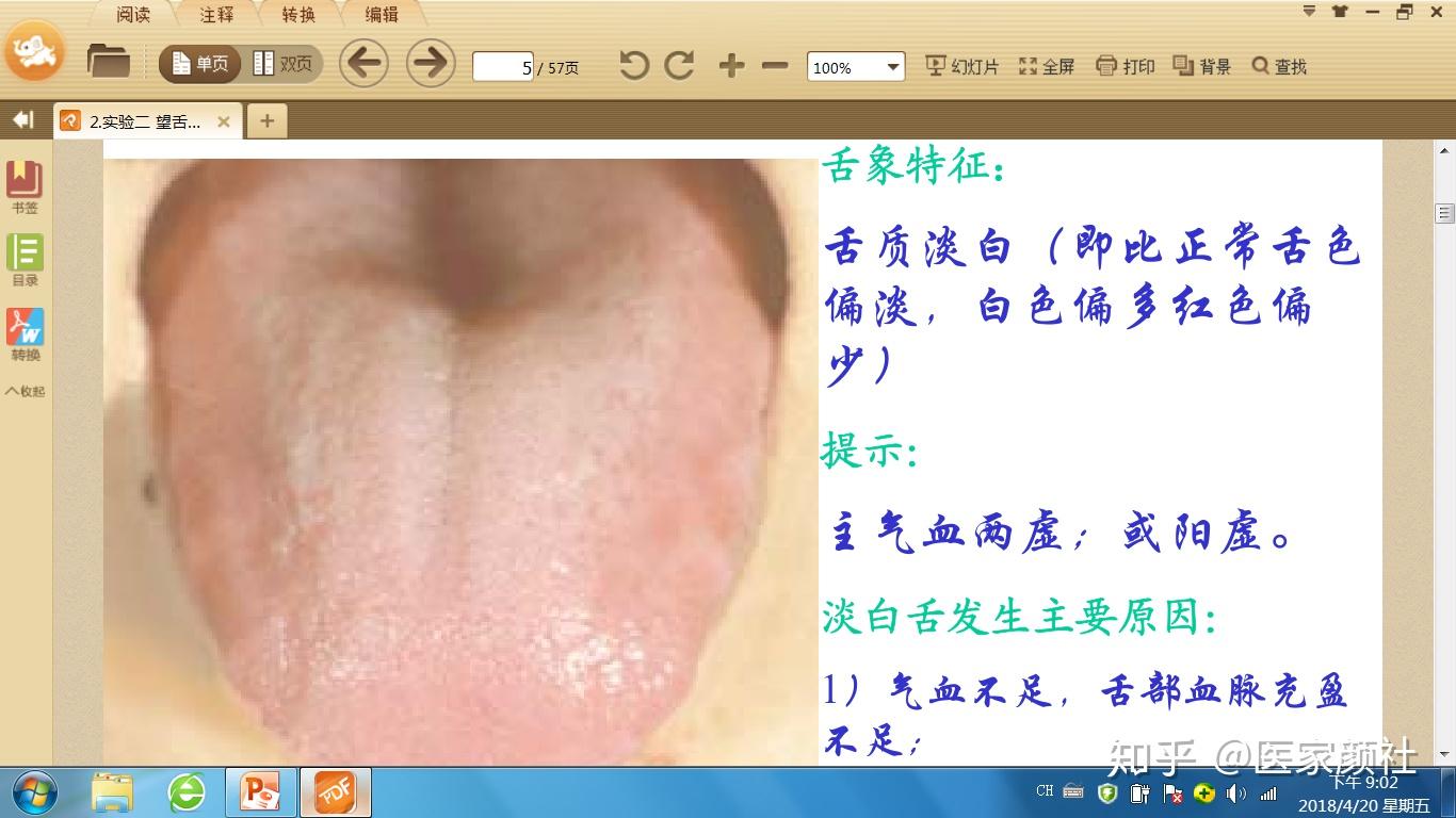 3.望舌形主要包括老嫩,胖瘦,点刺,裂纹和齿痕等方面.
