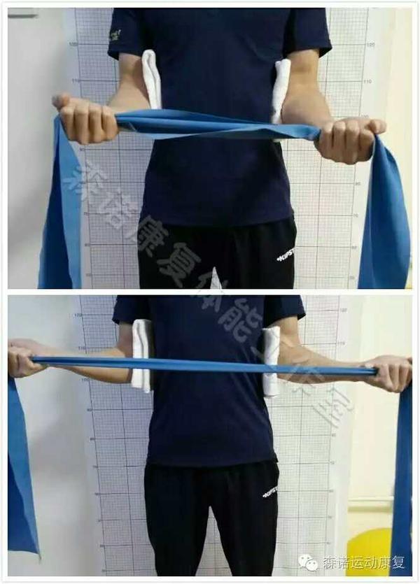 不良身体姿态:上交叉综合征